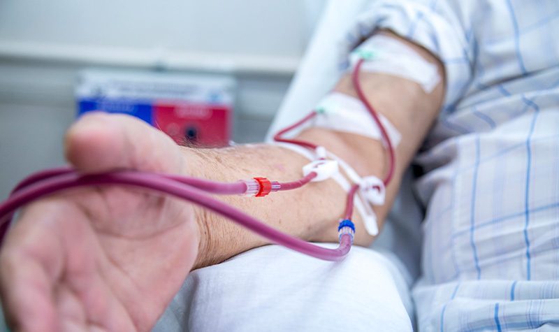 tipos de acesso vascular para hemodiálise